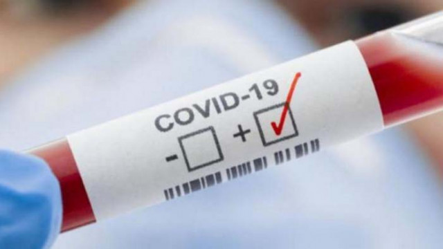 41 нови случая на covid-19 в област Русе  за последното денонощие